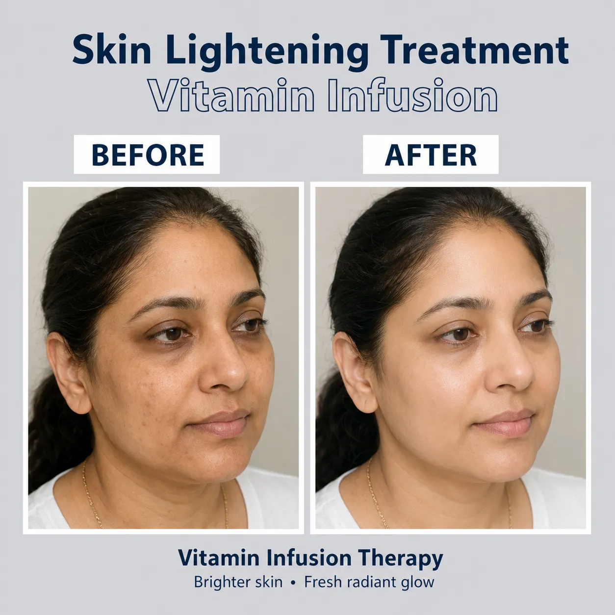 Skin Lightening Treatment Vitamin Infusion consultation at Dr Samavia Clinic Islamabad