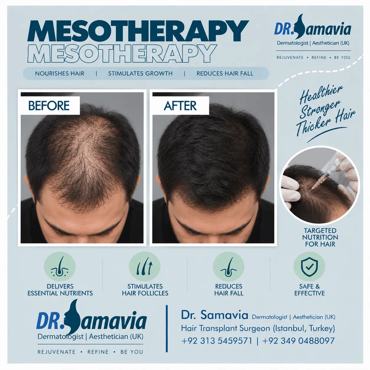 Mesotherapy consultation at Dr Samavia Clinic Islamabad
