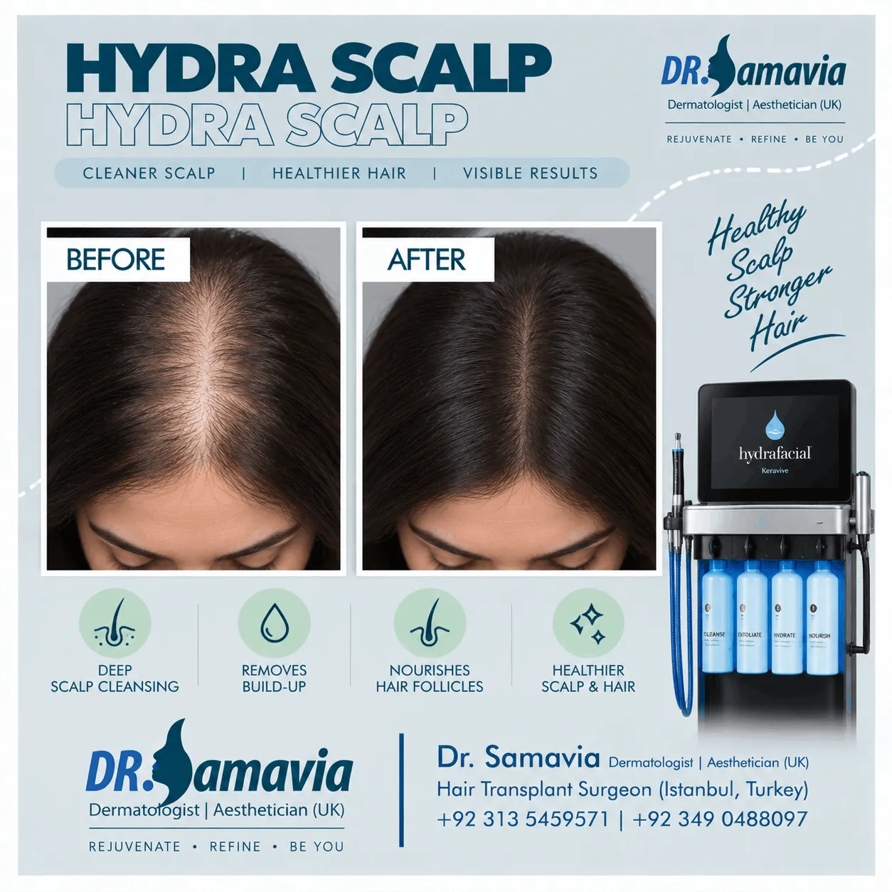 Hydra Scalp consultation at Dr Samavia Clinic Islamabad
