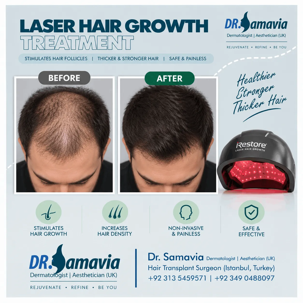 Laser Hair Growth Treatment consultation at Dr Samavia Clinic Islamabad