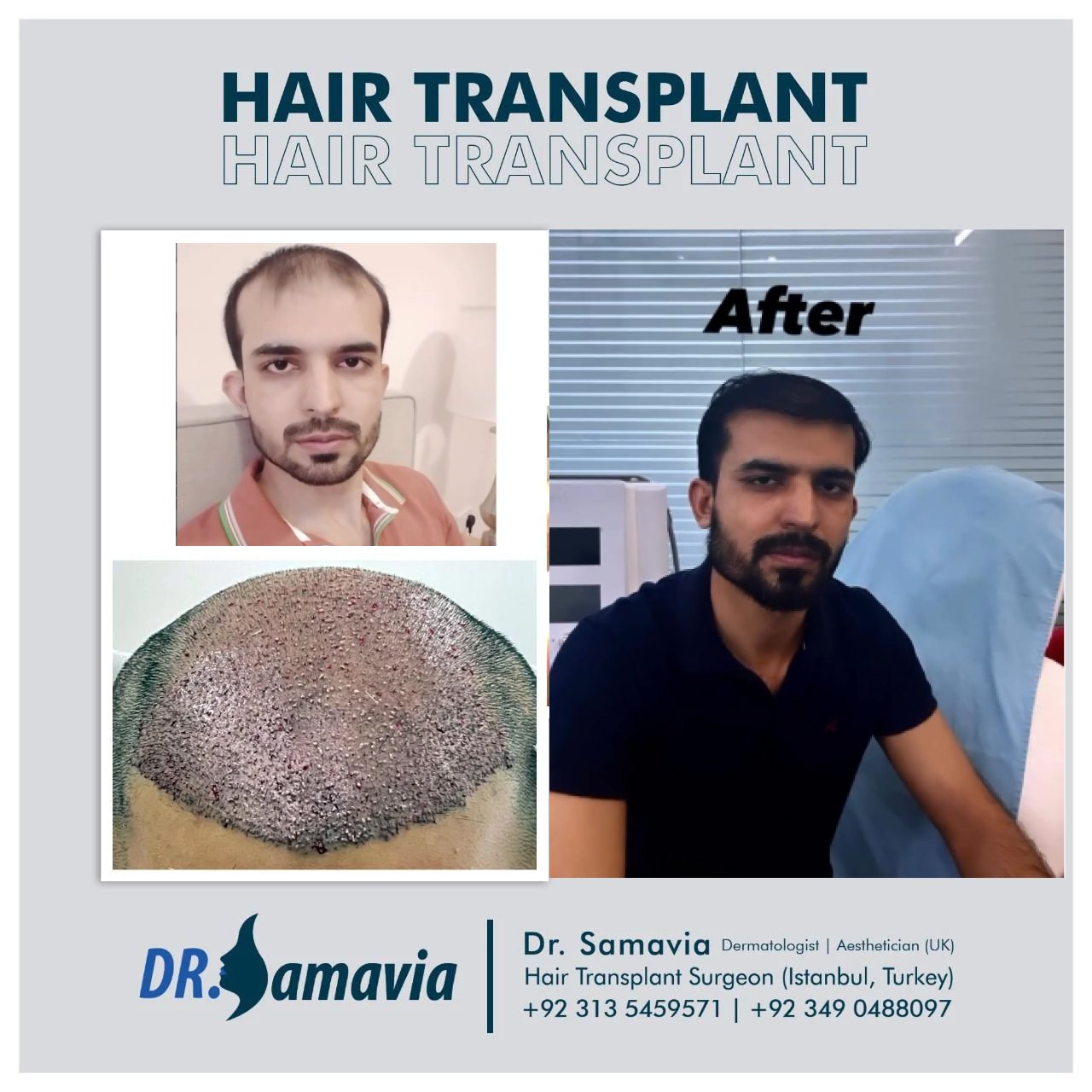 Hair treatment before and after result